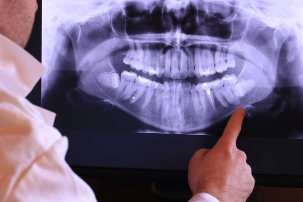 Best Root Canal Emergency Dentist  in Portland, MI